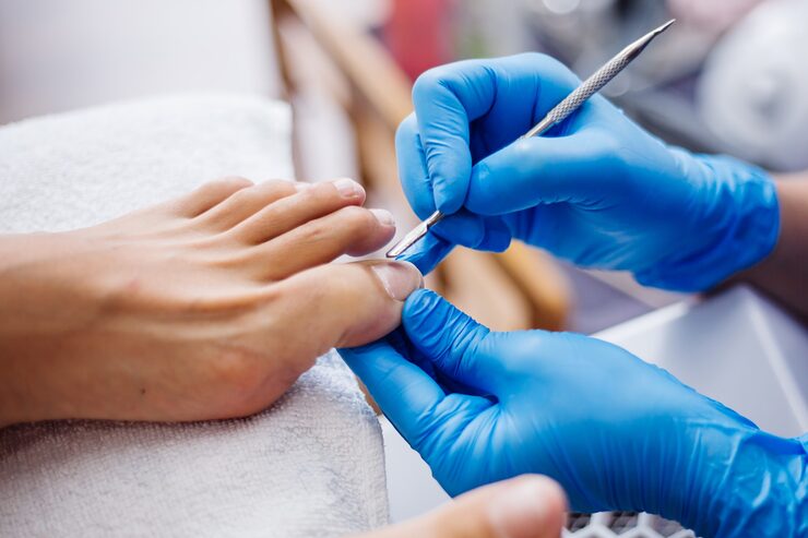 nail infection nail salon