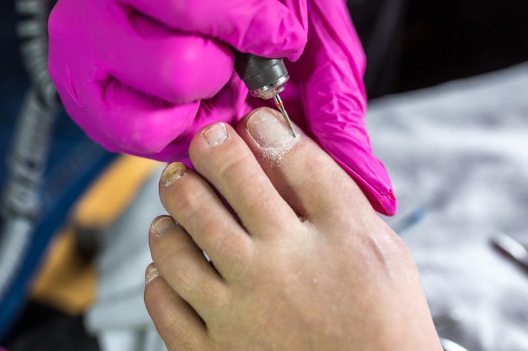 athlete foot nail salon